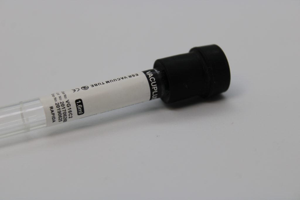 Eritrosit Sedimantasyon Tüpleri